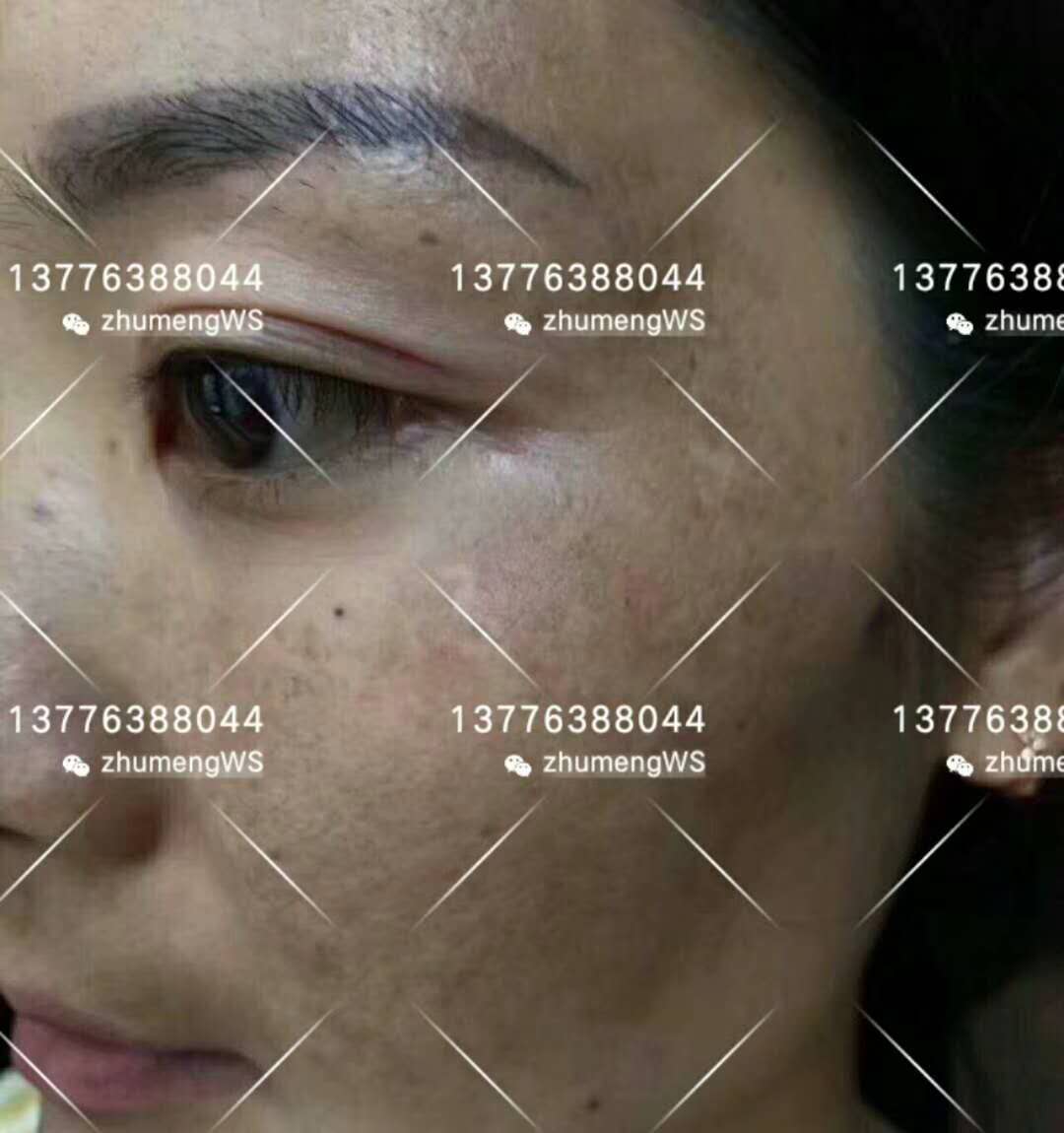 破后而重立04