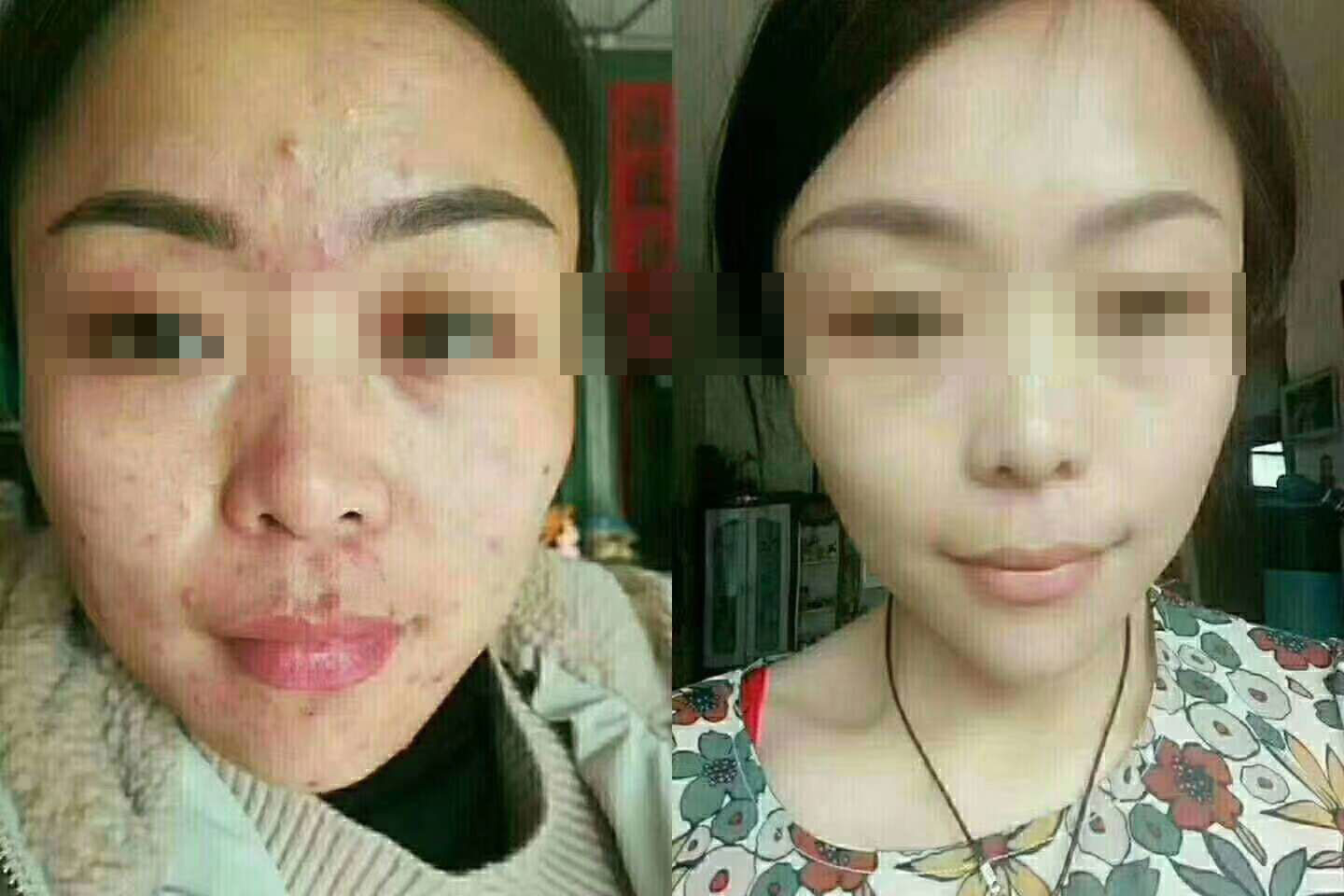 祛斑不要试试看，找准品牌是关键