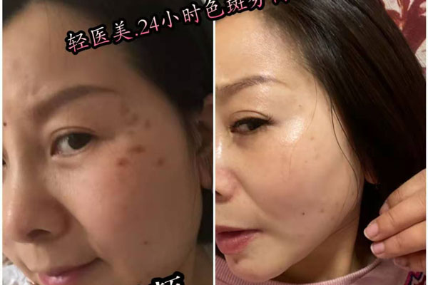 让客户用效果说话，行走的活广告