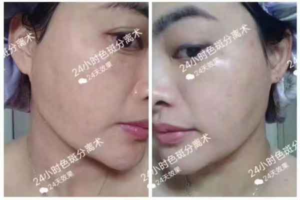 24天能干什么，能让自己变美丽